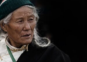 ノコギリヤシサプリは女性の薄毛にどのように効果があるの？