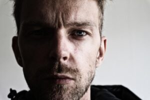30代におすすめの育毛サプリは何ですか？