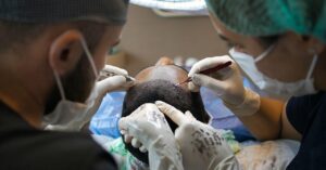 頭皮環境を改善するための効果的な方法は？